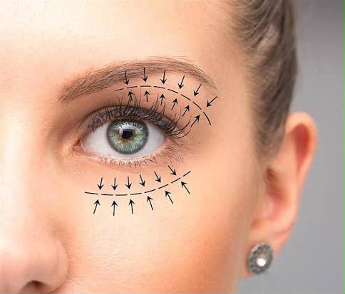 Eyelid surgery blepharoplasty at EsteCenter Istanbul