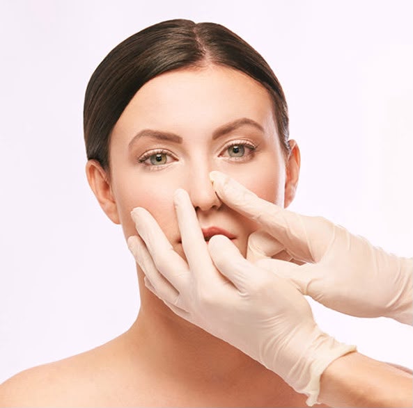 Revision rhinoplasty correcting a previous nose operation at EsteCenter Istanbul