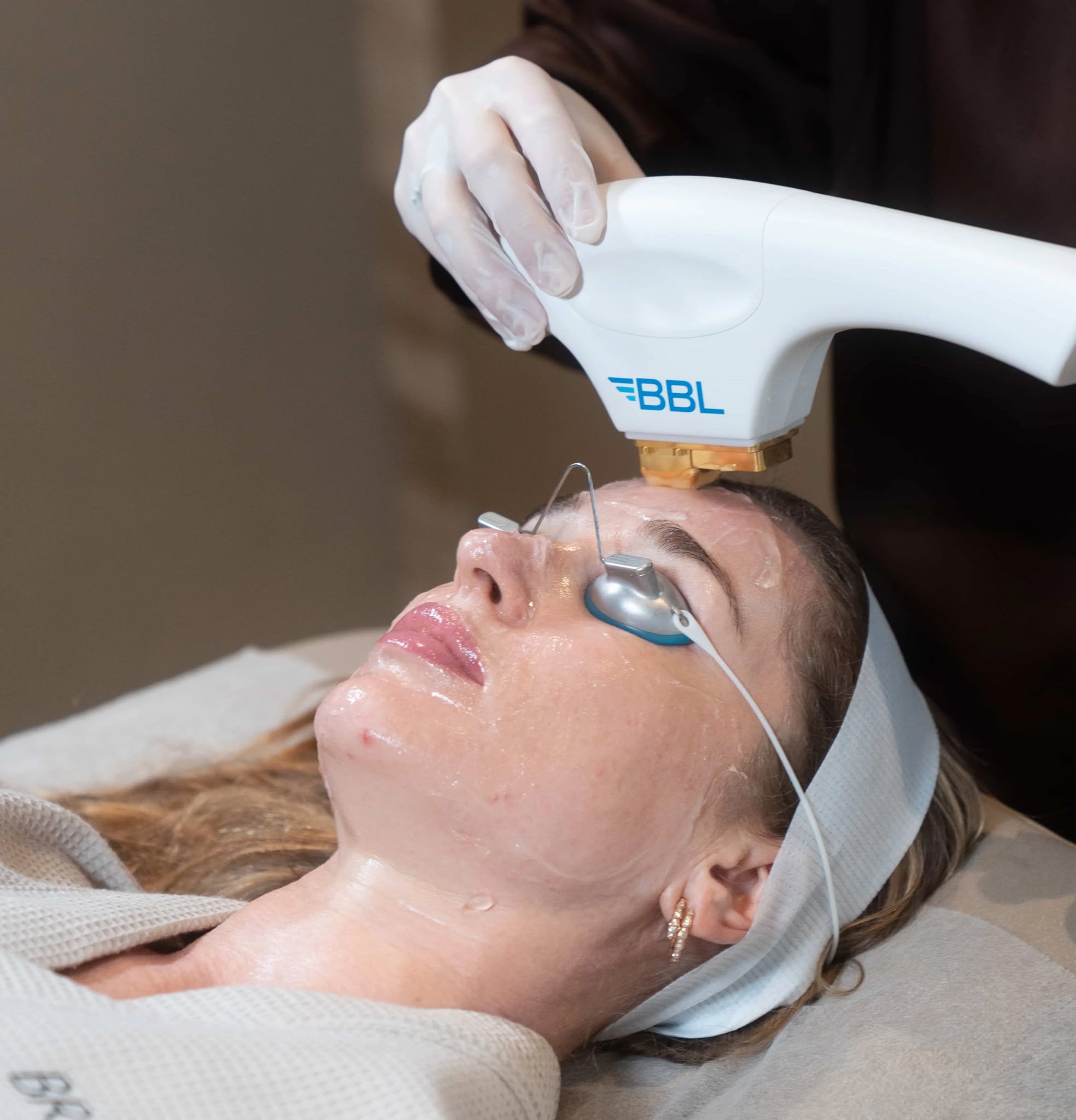 BBL BroadBand Light laser treatment at EsteCenter Istanbul
