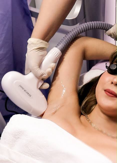 Laser hair removal at EsteCenter Istanbul