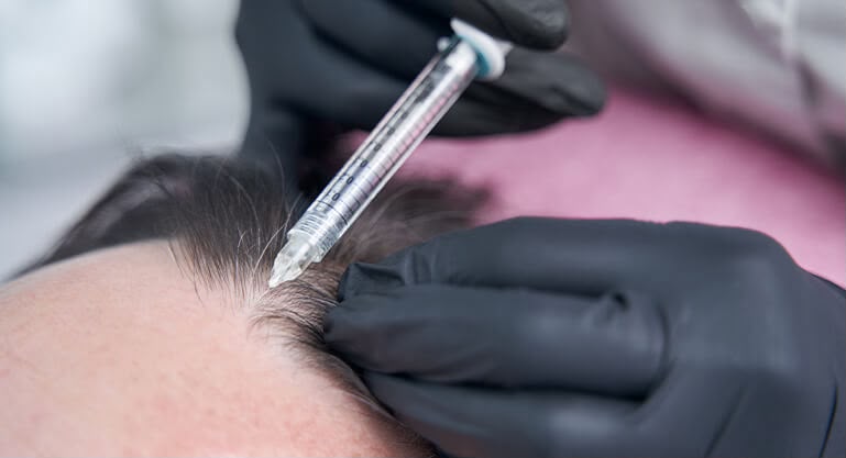 Mesotherapy skin booster injections at EsteCenter Istanbul