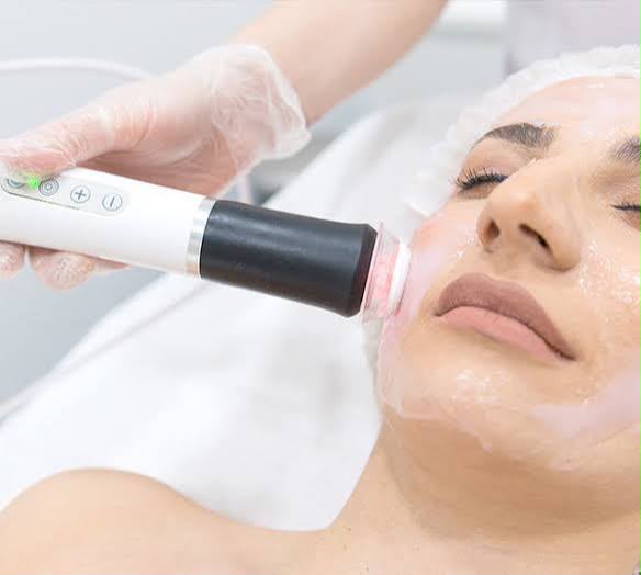 Red Touch laser rejuvenation at EsteCenter Istanbul