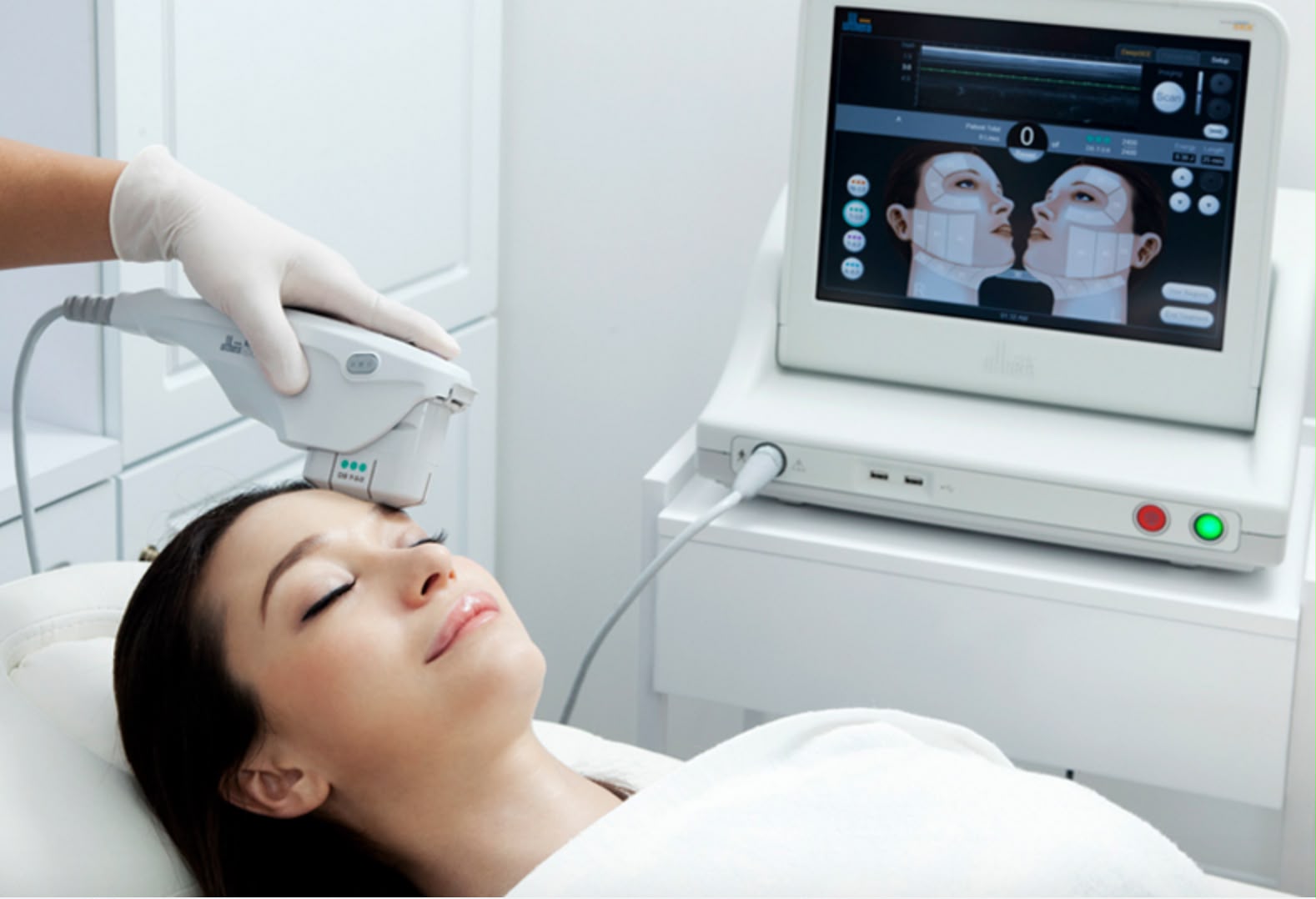 Ultherapy ultrasound skin lifting at EsteCenter Istanbul